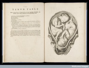 L0050657 The tenth table from "A sett of anatomical tables.."