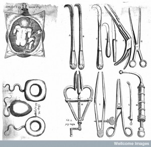 L0014388 Pessaries, foetus in utero, obsterical instruments.