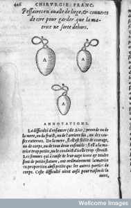 L0007243 Illustration of Pessaries, 16th century